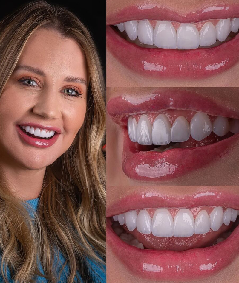 resultados-dental