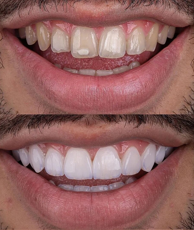 resultados-dental2