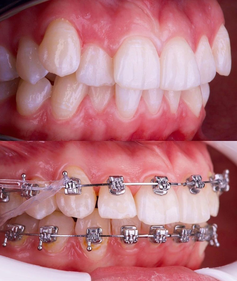 resultados-dental4