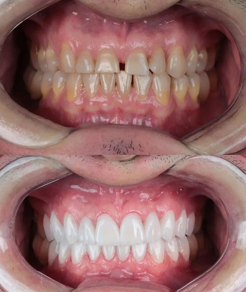 resultados-dental6